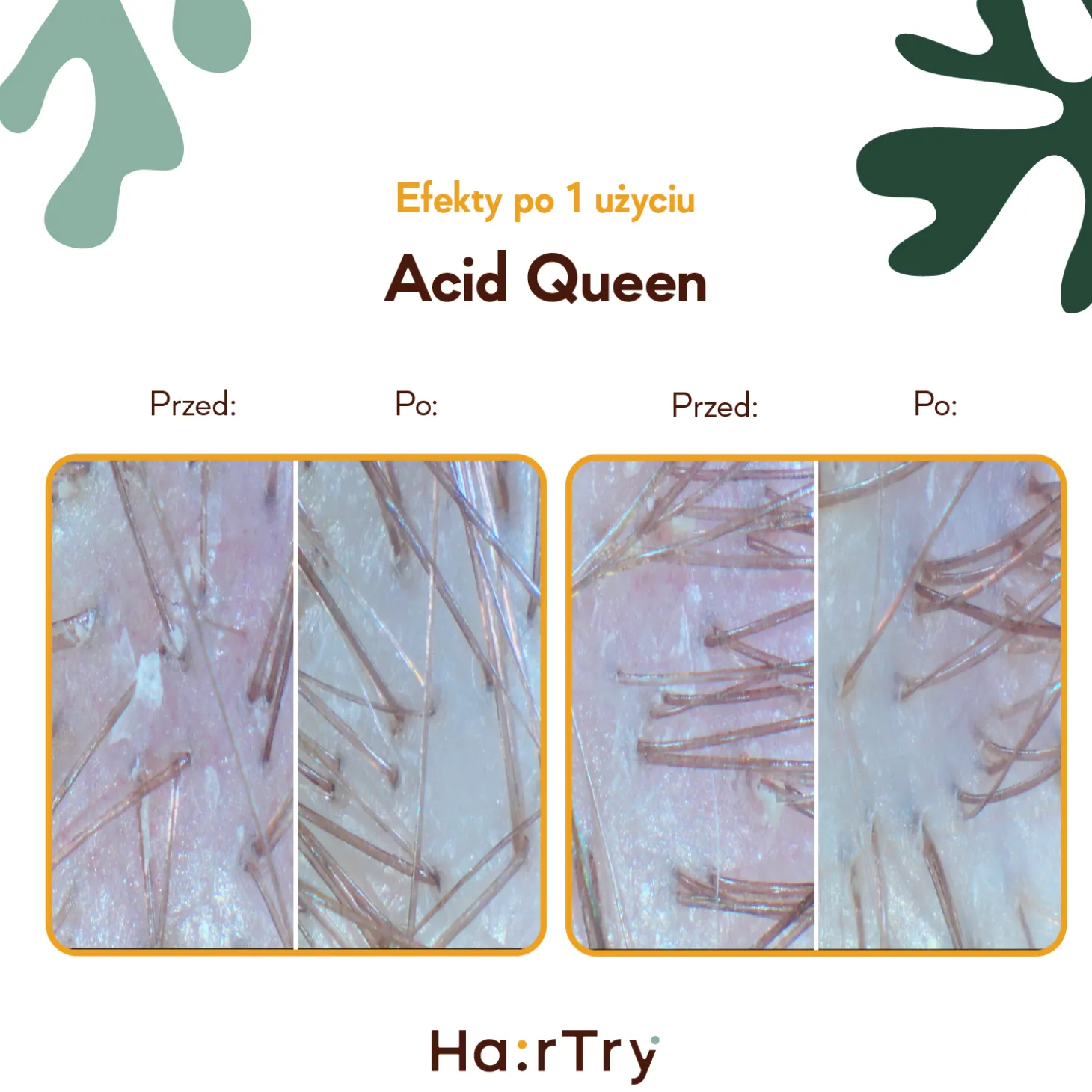 HairTry - Acid Queen - Trychologiczny Peeling Kwasowy do Skóry Głowy - 100ml