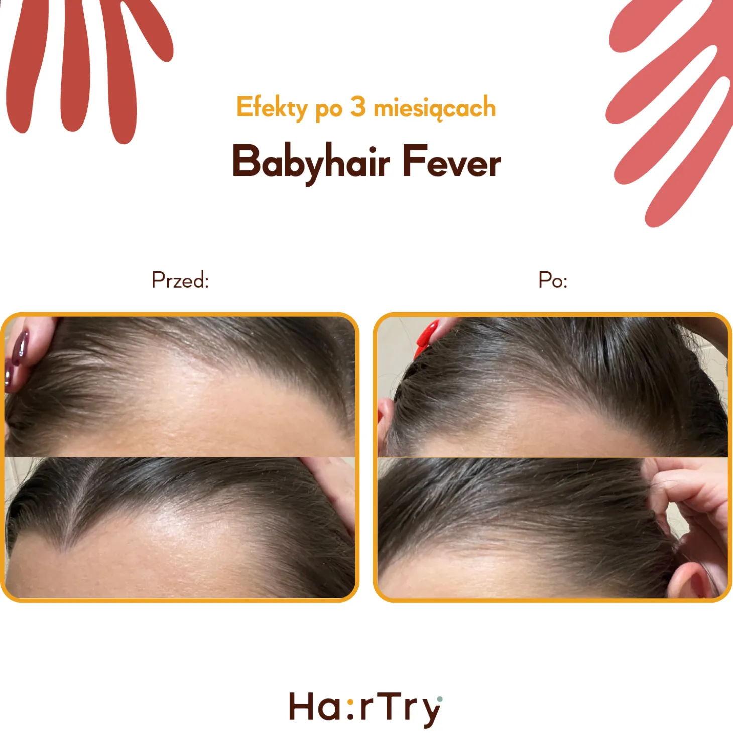 HairTry - Babyhair Fever - Wcierka Rozgrzewająca na Porost Włosów - 200ml