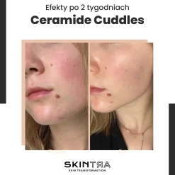 SkinTra - Ceramide Cuddles - Serum Regenerujące - 30ml