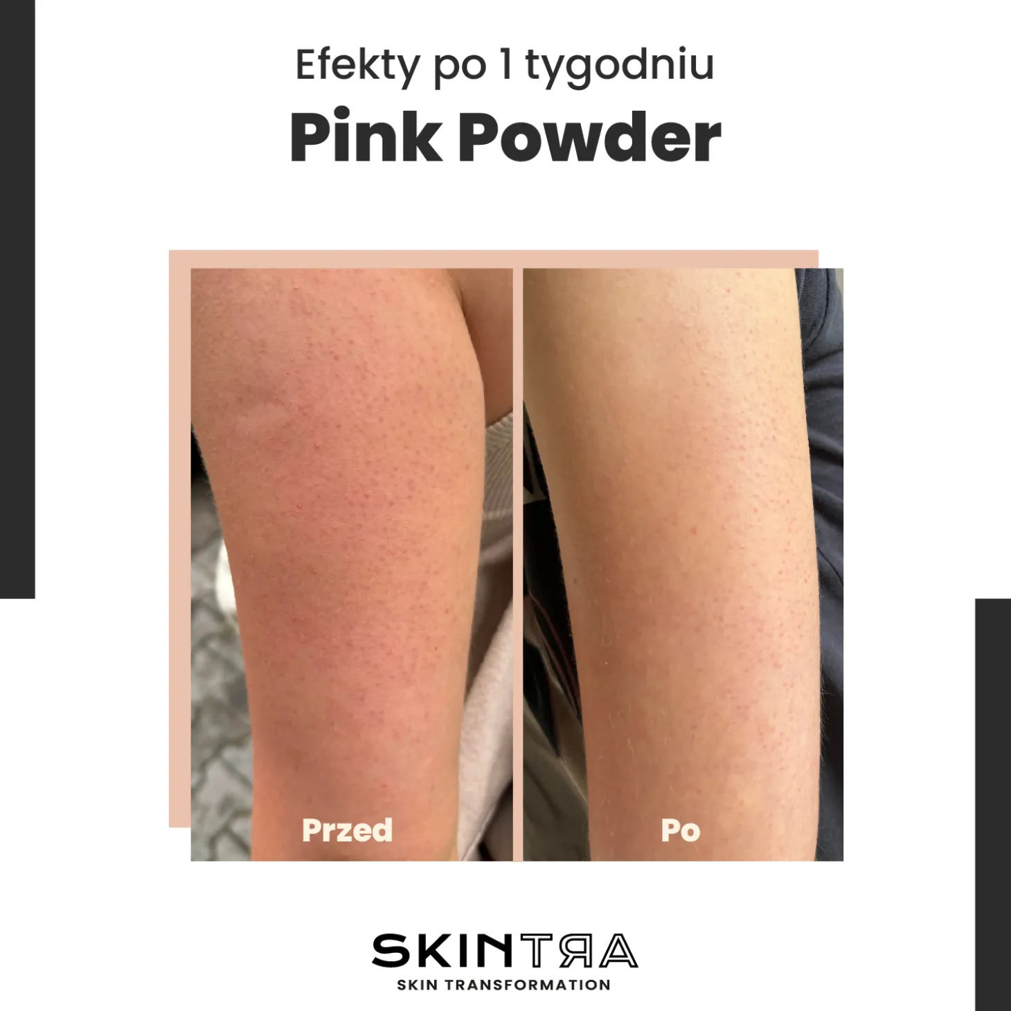 SkinTra - Pink Pow(d)er - Wielofunkcyjny Puder Oczyszczająco-Enzymatyczny Na Bazie Glinki - 40g