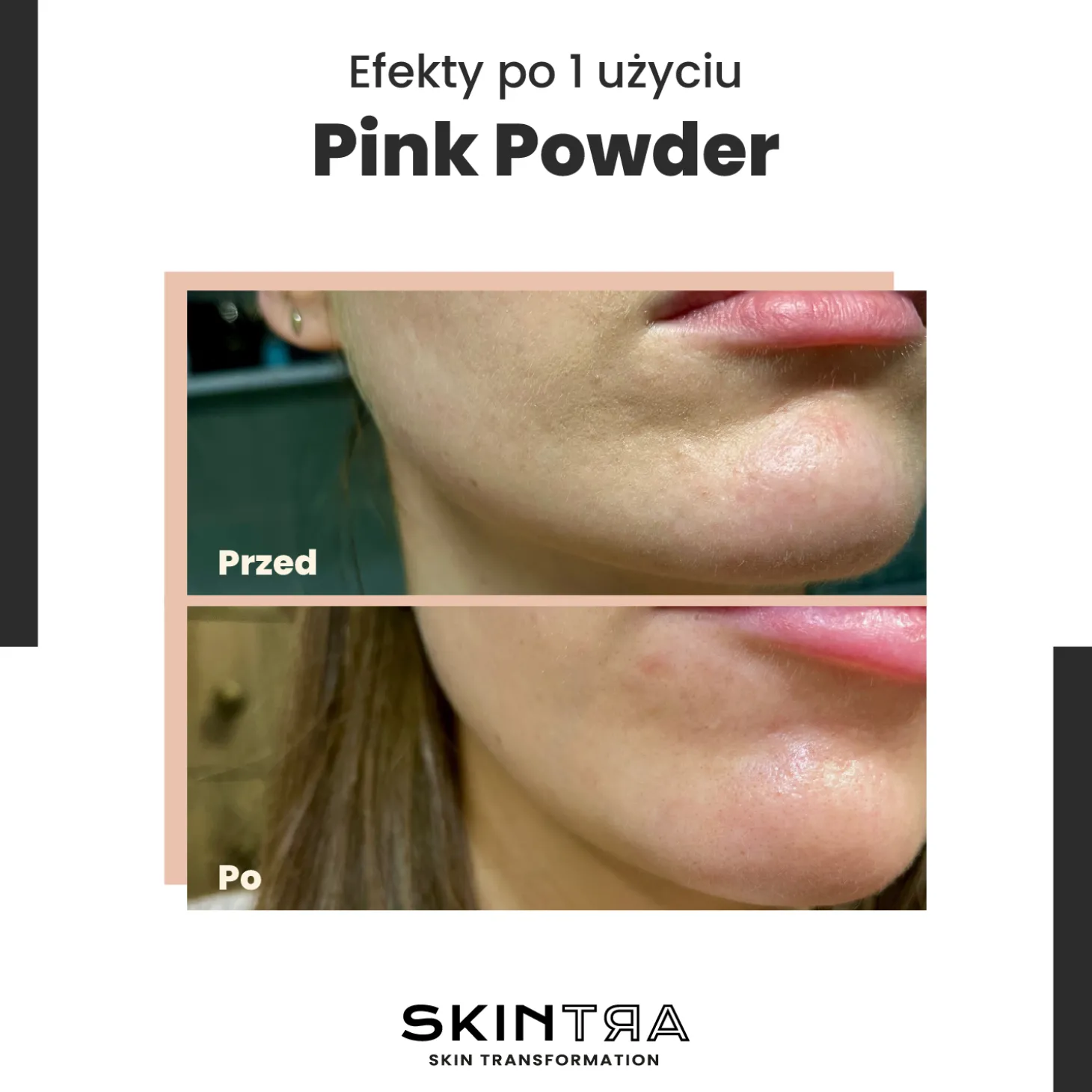 SkinTra - Pink Pow(d)er - Wielofunkcyjny Puder Oczyszczająco-Enzymatyczny Na Bazie Glinki - 40g