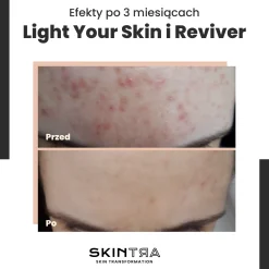 SkinTra - Reviver - Serum Rewitalizujące - 30ml