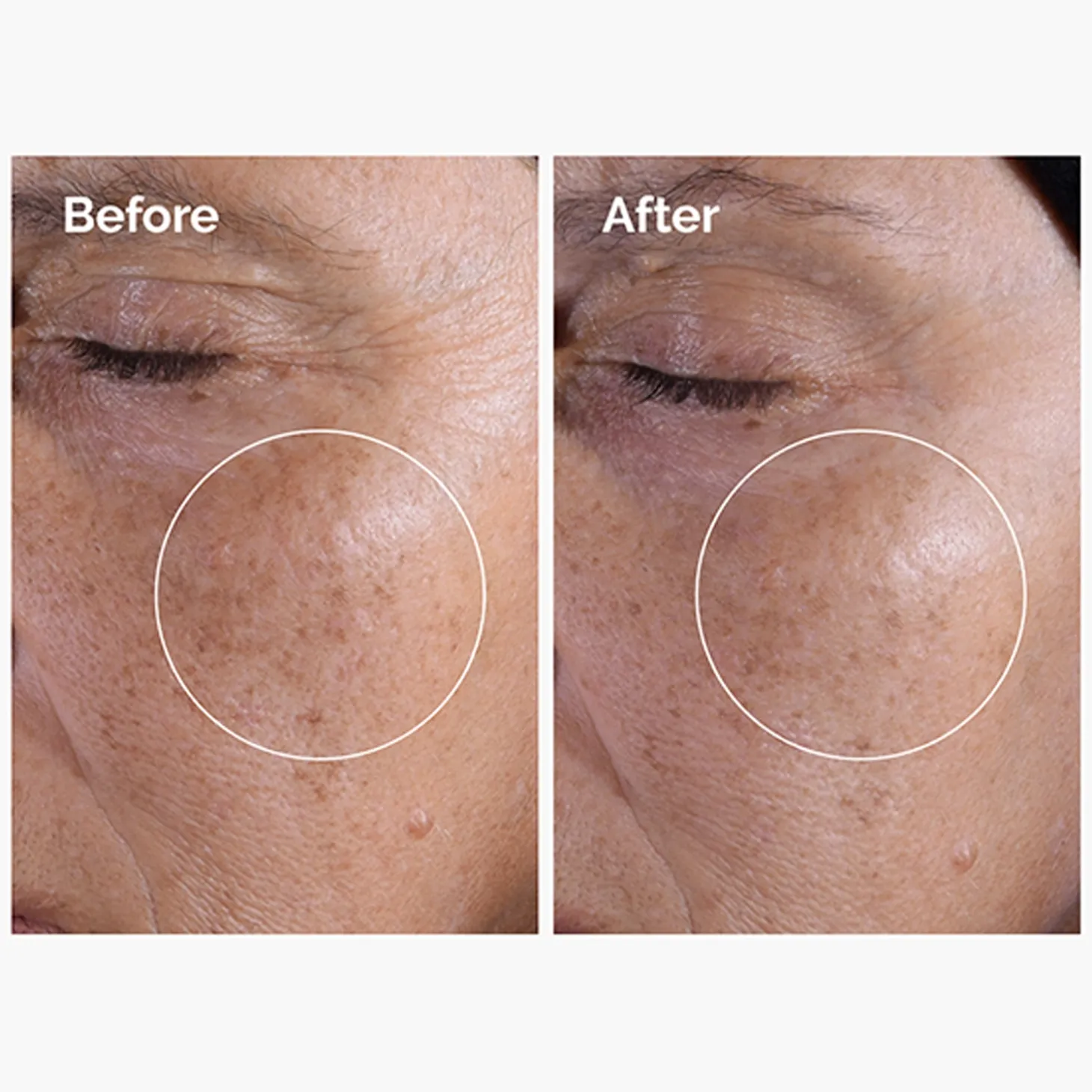 The Ordinary - Glycolic Acid 7% Exfoliating Toner - Tonik Peelingujący z 7% Kwasem Glikolowym - 100ml
