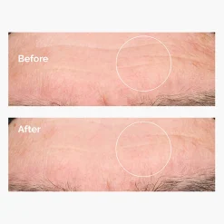 The Ordinary - Hyaluronic Acid 2% + B5 - Serum Nawilżające z Kwasem Hialuronowym 2% i Witaminą B5 - 30ml