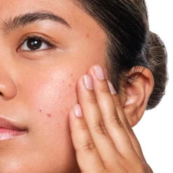 The Ordinary - Salicylic Acid 2% Solution - Serum z Kwasem Salicylowym - 30ml